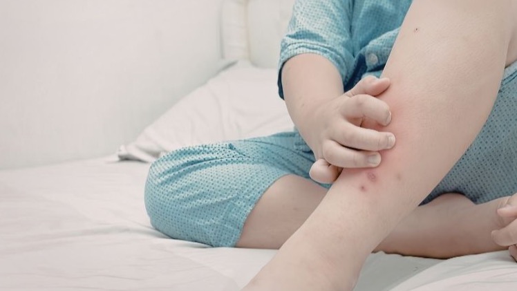 How to Keep Bed Bugs Out After Back-to-School Travel